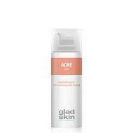 Gladskin Acne gel 50ml